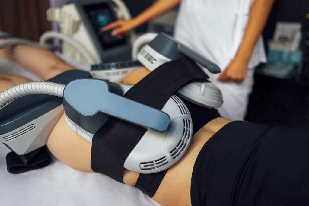 Resultados visibles de emsculpt – Comparativa antes y después del tratamiento de emsculpt en glúteos- clinica de fitness